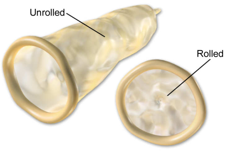 Diaphragm Archives - The Fact Factor