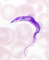 Kingdom Protista Trypanosoma