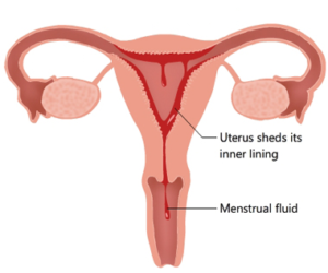 endometrium lining discharge